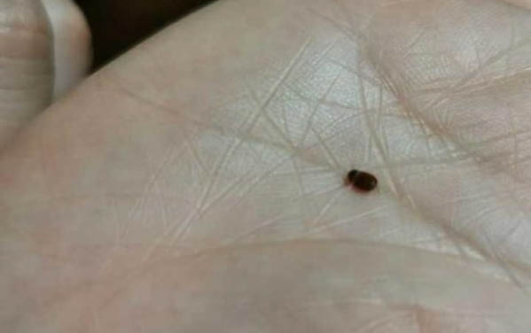 貓咪流鼻涕會傳染給另一只貓嗎