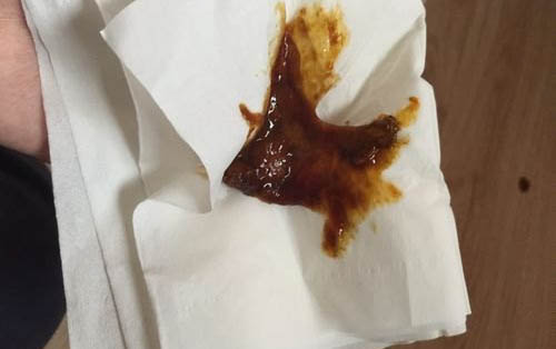 狗病毒性腸炎怎么辦