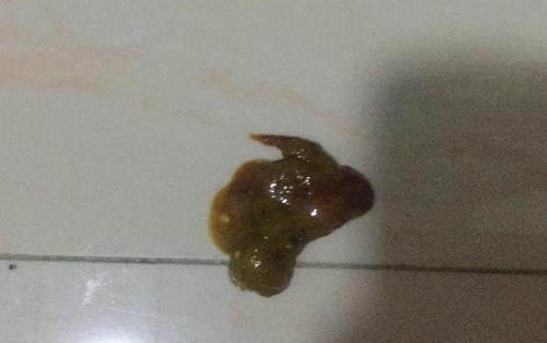 小狗偶爾咳嗽一聲用去醫院嗎
